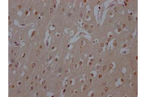 IHC image of ABIN7127433 diluted at 1:100 and staining in paraffin-embedded human brain tissue performed on a Leica BondTM system. (Recombinant COMT 抗体)