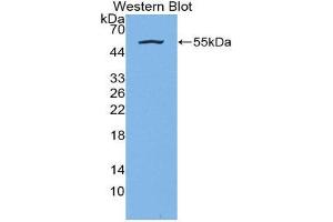 Western Blotting (WB) image for anti-Kallikrein 7 (KLK7) (AA 24-255) antibody (ABIN3205843) (Kallikrein 7 抗体  (AA 24-255))