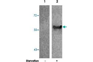 Western blot analysis of extract from 293 cells untreated or treated starvation using G3BP1 (phospho S232) polyclonal antibody .