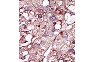 Image no. 1 for anti-Activin A Receptor Type II-Like 1 (ACVRL1) (N-Term) antibody (ABIN360124) (ACVRL1 抗体  (N-Term))