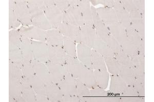 Immunoperoxidase of monoclonal antibody to ARX on formalin-fixed paraffin-embedded human skeletal muscle. (Arx 抗体  (AA 1-95))