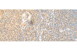 Immunohistochemistry of paraffin-embedded Human tonsil tissue using SSC4D Polyclonal Antibody at dilution of 1:70(x200) (SRCRB4D 抗体)