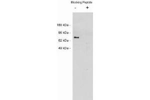 Image no. 1 for anti-Netrin 1 (NTN1) antibody (ABIN265183) (Netrin 1 抗体)