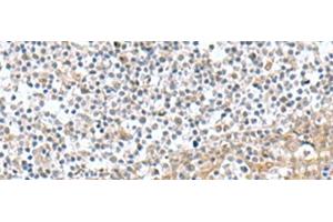 Immunohistochemistry of paraffin-embedded Human tonsil tissue using TNNC2 Polyclonal Antibody at dilution of 1:50(x200) (TNNC2 抗体)