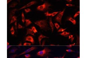 Immunofluorescence analysis of NIH/3T3 cells using FXR1 Polyclonal Antibody at dilution of 1:100. (FXR1 抗体)