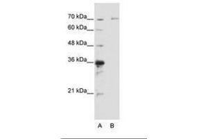 Image no. 1 for anti-Interleukin-1 Receptor-Associated Kinase 3 (IRAK3) (AA 441-490) antibody (ABIN6736196) (IRAK3 抗体  (AA 441-490))