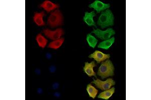 ABIN6265302 and ABIN6278531 staining Hela cells by IF/ICC.