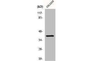 Western Blot analysis of COLO205 cells using Dok-6 Polyclonal Antibody (DOK6 抗体  (Internal Region))