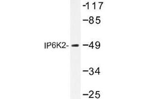 Image no. 1 for anti-Inositol Hexakisphosphate Kinase 2 (IP6K2) antibody (ABIN317720) (IP6K2 抗体)