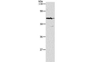 Western Blot analysis of Hela cell using PKM Polyclonal Antibody at dilution of 1:500 (PKM 抗体)