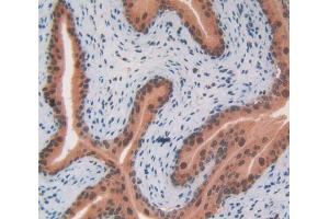 IHC-P analysis of Mouse Testis Tissue, with DAB staining. (CS 抗体  (AA 174-428))