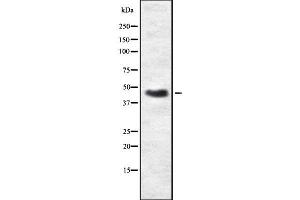 Western Blotting (WB) image for anti-Protein Kinase, CAMP-Dependent, Regulatory, Type II, beta (PRKAR2B) (Internal Region) antibody (ABIN6264424)