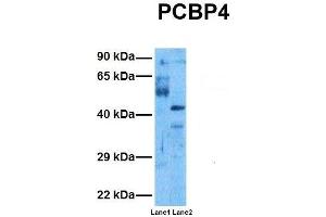 Host:  Rabbit  Target Name:  PCBP4  Sample Tissue:  Human Ovary Tumor, Human 293T  Antibody Dilution:  1. (PCBP4 抗体  (C-Term))