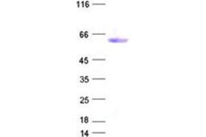 Western Blotting (WB) image for Asialoglycoprotein Receptor 1 (ASGR1) protein (DYKDDDDK Tag) (ABIN2714980)