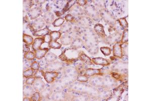 Immunohistochemistry (IHC) image for anti-Solute Carrier Family 9, Subfamily A (NHE1, Cation Proton Antiporter 1), Member 1 (SLC9A1) (AA 543-815) antibody (ABIN3043932)