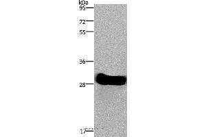 Western blot analysis of Mouse heart tissue, using FHL2 Polyclonal Antibody at dilution of 1:1900 (FHL2 抗体)