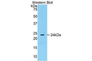 Western Blotting (WB) image for anti-Fibrinogen alpha Chain (FGA) (AA 357-556) antibody (ABIN1174272)