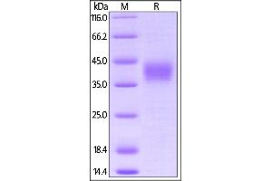 SDS-PAGE (SDS) image for Fc Fragment of IgG, Low Affinity IIIb, Receptor (CD16b) (FCGR3B) (AA 17-208) (Active) protein (His tag,AVI tag,Biotin) (ABIN5674580)