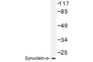 Image no. 1 for anti-Synuclein, alpha (SNCA) antibody (ABIN317944) (SNCA 抗体)