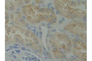 Detection of BMX in Human Kidney Tissue using Polyclonal Antibody to BMX Non Receptor Tyrosine Kinase (BMX) (BMX 抗体  (AA 287-523))