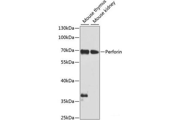 Perforin 1 抗体