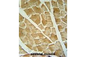 ARHGAP10 antibody (Center) immunohistochemistry analysis in formalin fixed and paraffin embedded human skeletal muscle followed by peroxidase conjugation of the secondary antibody and DAB staining. (ARHGAP10 抗体  (Middle Region))