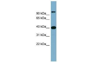 Cyclin D-Type Binding-Protein 1 antibody used at 1 ug/ml to detect target protein. (CCNDBP1 抗体  (Middle Region))
