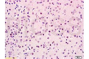 Formalin-fixed and paraffin embedded rat brain tissue labeled with Anti-GIG8/ID2 Polyclonal Antibody, Unconjugated (ABIN747473) at 1:100 followed by conjugation to the secondary antibody and DAB staining (Id2 抗体  (AA 31-134))