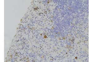 ABIN6273119 at 1/100 staining Human lymph node tissue by IHC-P. (GSDMD 抗体)