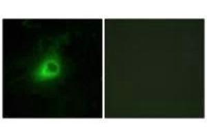 Immunofluorescence analysis of HeLa cells, using GRK6 antibody. (GRK6 抗体  (N-Term))