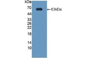 Western Blotting (WB) image for anti-Corticotropin Releasing Hormone Binding Protein (CRHBP) (AA 25-322) antibody (ABIN7434878)