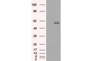 HEK293T cells were transfected with the pCMV6-ENTRY control (Left lane) or pCMV6-ENTRY KRT8 (Right lane) cDNA for 48 hrs and lysed. (KRT8 抗体  (AA 91-381))