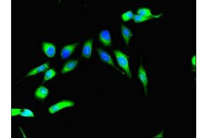 Immunofluorescent analysis of Hela cells using ABIN7168184 at dilution of 1:100 and Alexa Fluor 488-congugated AffiniPure Goat Anti-Rabbit IgG(H+L) (MSK2 抗体  (AA 237-393))