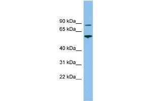 WB Suggested Anti-VPS52 Antibody Titration: 0. (VPS52 抗体  (Middle Region))