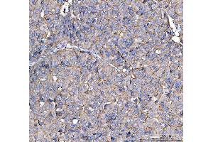 IHC analysis of CD13/Anpep using anti-CD13/Anpep antibody (ABIN7602222).