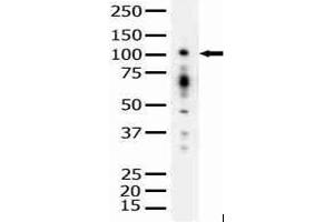 Image no. 1 for anti-Protein Kinase D1 (PRKD1) antibody (ABIN272066) (PKC mu 抗体)