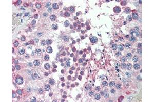 MED4 antibody was used for immunohistochemistry at a concentration of 4-8 ug/ml. (MED4 抗体  (C-Term))