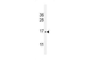 Western blot analysis in HepG2 cell line lysates (35ug/lane). (CST9 抗体  (C-Term))