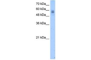 Protein C antibody used at 2. (PROC 抗体)
