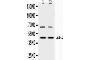 Western blot analysis of MPI expression in rat testis extract ( Lane 1) and HELA whole cell lysates ( Lane 2). (MPI 抗体  (AA 2-99))