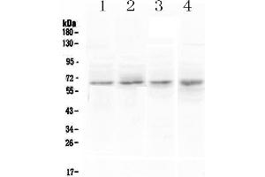 Western blot analysis of CCKBR using anti-CCKBR antibody . (CCKBR 抗体)