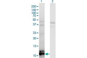 Western Blot analysis of TIAF1 expression in transfected 293T cell line by TIAF1 monoclonal antibody (M04), clone 3B9. (TIAF1 抗体  (AA 1-115))