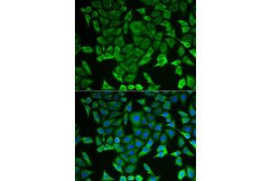 Immunofluorescence analysis of MCF-7 cells using RARS antibody (ABIN5973728). (RARS 抗体)