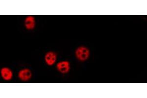 ABIN6274039 staining HepG2 by IF/ICC. (PPP1CA + 1CB 抗体)