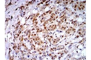 Immunohistochemistry (IHC) image for anti-Proteasome (Prosome, Macropain) 26S Subunit, ATPase, 3 (PSMC3) (AA 53-152) antibody (ABIN5542634)