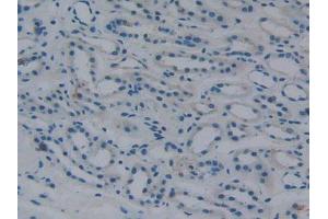 DAB staining on IHC-P; Samples: Human Kidney Tissue. (Fibrinogen beta Chain 抗体  (AA 45-491))