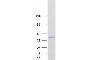 Western Blotting (WB) image for Spindle and Kinetochore Associated Complex Subunit 1 (SKA1) (Transcript Variant 1) protein (Myc-DYKDDDDK Tag) (ABIN2732102)