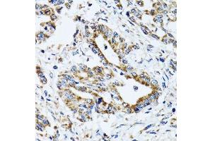 Immunohistochemistry (Paraffin-embedded Sections) (IHC (p)) image for anti-ATP Synthase, H+ Transporting, Mitochondrial F1 Complex, beta Polypeptide (ATP5B) (AA 230-529) antibody (ABIN6137326)