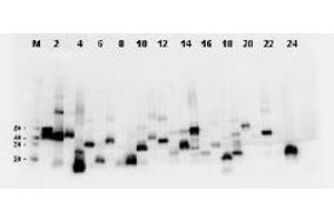 Western Blotting (WB) image for anti-DYKDDDDK Tag antibody (ABIN400788)