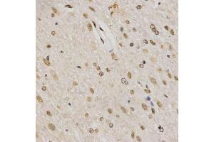 Immunohistochemistry of paraffin-embedded rat brain using TriMethyl-Histone H3-K79 antibody.